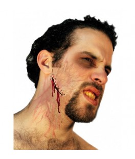 Cicatrice points de suture